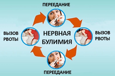 Лечение булимии в Троицкой